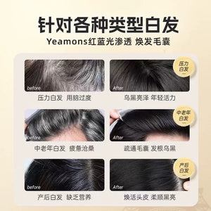 Black technology comb - white - hair - red and blue light massage does not hurt the scalp or hair - natural black 【欧洲专研】黑科技梳子-白-髪-红蓝光按摩不伤头皮不伤发-自然黑