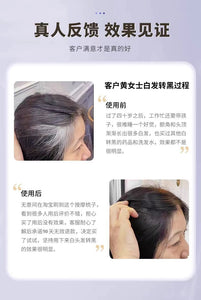 Black technology comb - white - hair - red and blue light massage does not hurt the scalp or hair - natural black 【欧洲专研】黑科技梳子-白-髪-红蓝光按摩不伤头皮不伤发-自然黑