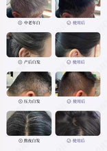 将图片加载到图库查看器，Black technology comb - white - hair - red and blue light massage does not hurt the scalp or hair - natural black 【欧洲专研】黑科技梳子-白-髪-红蓝光按摩不伤头皮不伤发-自然黑
