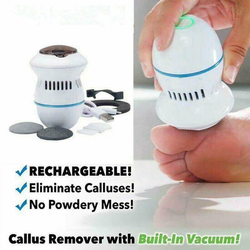 Electric Foot File Vacuum Callus Remover – JadoJacob